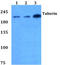 TSC Complex Subunit 2 antibody, AP06591PU-N, Origene, Western Blot image 
