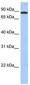 Transmembrane And Tetratricopeptide Repeat Containing 1 antibody, TA331004, Origene, Western Blot image 