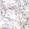 SWI/SNF Related, Matrix Associated, Actin Dependent Regulator Of Chromatin, Subfamily A, Member 4 antibody, LS-C335201, Lifespan Biosciences, Immunohistochemistry paraffin image 