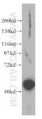 Papillary thyroid carcinoma-encoded protein antibody, 13717-1-AP, Proteintech Group, Western Blot image 