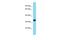 Kinetochore Localized Astrin (SPAG5) Binding Protein antibody, A08791, Boster Biological Technology, Western Blot image 