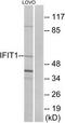 Interferon Induced Protein With Tetratricopeptide Repeats 1 antibody, TA311892, Origene, Western Blot image 