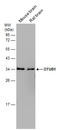 OTU Deubiquitinase, Ubiquitin Aldehyde Binding 1 antibody, GTX101973, GeneTex, Western Blot image 