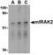 Interleukin 1 Receptor Associated Kinase 2 antibody, NBP1-76641, Novus Biologicals, Western Blot image 