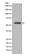 Glucose-6-Phosphate Isomerase antibody, M00108-1, Boster Biological Technology, Western Blot image 