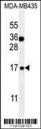 S100 Calcium Binding Protein A1 antibody, 56-036, ProSci, Western Blot image 