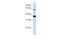 Sphingomyelin Phosphodiesterase 3 antibody, A04641, Boster Biological Technology, Western Blot image 