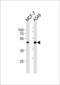 Cyclin Dependent Kinase 20 antibody, LS-C203936, Lifespan Biosciences, Western Blot image 