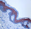 Keratin 1 antibody, 905204, BioLegend, Immunohistochemistry frozen image 