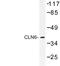 CLN6 Transmembrane ER Protein antibody, LS-C177359, Lifespan Biosciences, Western Blot image 