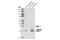 Matrix Metallopeptidase 7 antibody, 3801P, Cell Signaling Technology, Western Blot image 