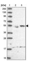 CCZ1 Homolog, Vacuolar Protein Trafficking And Biogenesis Associated antibody, PA5-60927, Invitrogen Antibodies, Western Blot image 
