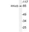 Component Of Inhibitor Of Nuclear Factor Kappa B Kinase Complex antibody, LS-C176604, Lifespan Biosciences, Western Blot image 