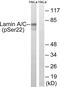 Lamin A/C antibody, LS-C199187, Lifespan Biosciences, Western Blot image 