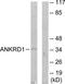 Ankyrin repeat domain-containing protein 1 antibody, TA315359, Origene, Western Blot image 