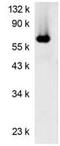 Laminin Subunit Alpha 1 antibody, MA1-12556, Invitrogen Antibodies, Western Blot image 