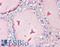 Thyroglobulin antibody, LS-B3171, Lifespan Biosciences, Immunohistochemistry paraffin image 