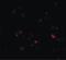 DEAD-Box Helicase 3 X-Linked antibody, LS-B2348, Lifespan Biosciences, Immunofluorescence image 