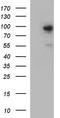 FES Proto-Oncogene, Tyrosine Kinase antibody, TA590713, Origene, Western Blot image 