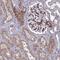 Tensin 1 antibody, NBP1-84130, Novus Biologicals, Immunohistochemistry paraffin image 