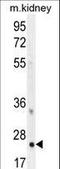 Homeobox B6 antibody, LS-C164982, Lifespan Biosciences, Western Blot image 