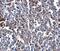 Calcium release-activated calcium channel protein 1 antibody, M00909, Boster Biological Technology, Immunohistochemistry paraffin image 