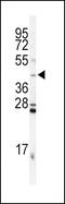 Inhibin Subunit Alpha antibody, PA5-13681, Invitrogen Antibodies, Western Blot image 