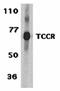 Interleukin 27 Receptor Subunit Alpha antibody, orb74453, Biorbyt, Western Blot image 