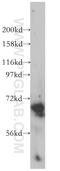 Chondroitin Sulfate Synthase 1 antibody, 14420-1-AP, Proteintech Group, Western Blot image 