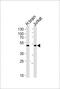 Chimerin 1 antibody, PA5-49289, Invitrogen Antibodies, Western Blot image 