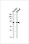 Chimerin 1 antibody, PA5-49289, Invitrogen Antibodies, Western Blot image 