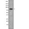 Acyl-CoA Dehydrogenase Family Member 11 antibody, abx147902, Abbexa, Western Blot image 