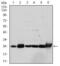 Glutathione S-Transferase Mu 1 antibody, GTX60526, GeneTex, Western Blot image 