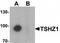 Teashirt Zinc Finger Homeobox 1 antibody, TA319809, Origene, Western Blot image 