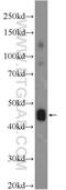 Family With Sequence Similarity 189 Member A2 antibody, 25630-1-AP, Proteintech Group, Western Blot image 