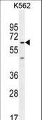 Kelch Like Family Member 40 antibody, LS-C165404, Lifespan Biosciences, Western Blot image 