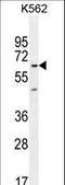 Kelch repeat and BTB domain-containing protein 5 antibody, LS-C165404, Lifespan Biosciences, Western Blot image 