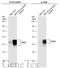 FOS Like 2, AP-1 Transcription Factor Subunit antibody, GTX134241, GeneTex, Western Blot image 