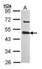 Ubiquitin Specific Peptidase 18 antibody, GTX103145, GeneTex, Western Blot image 