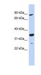 PDLIM1 Interacting Kinase 1 Like antibody, NBP1-56733, Novus Biologicals, Western Blot image 