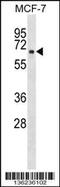 Ribitol Xylosyltransferase 1 antibody, 58-672, ProSci, Western Blot image 