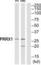 Paired Related Homeobox 1 antibody, abx014693, Abbexa, Western Blot image 