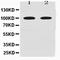 Myelin Associated Glycoprotein antibody, orb170188, Biorbyt, Western Blot image 