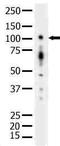 Serine/threonine-protein kinase D1 antibody, LS-C176456, Lifespan Biosciences, Western Blot image 