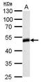Homer Scaffold Protein 1 antibody, TA308978, Origene, Western Blot image 