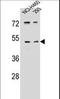 Serine Protease 55 antibody, LS-C203712, Lifespan Biosciences, Western Blot image 