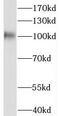 DEAD-Box Helicase 10 antibody, FNab02295, FineTest, Western Blot image 
