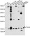 Thyroid Stimulating Hormone Subunit Beta antibody, LS-C749525, Lifespan Biosciences, Western Blot image 