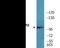 Glutamate Ionotropic Receptor AMPA Type Subunit 2 antibody, EKC2419, Boster Biological Technology, Western Blot image 