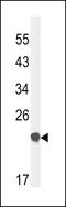 Claudin 23 antibody, 64-138, ProSci, Western Blot image 